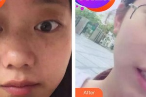 成都艾尚醫(yī)學美容門診部王琳整形價格表附祛斑案例展示