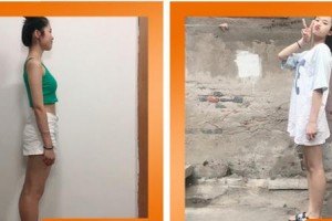 成都百齡駐顏醫(yī)學(xué)美容門診部肖宛平整形價(jià)格表附美體塑形案例展示