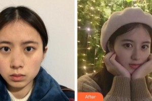 成都花田醫(yī)療美容門診部彭忠整形價(jià)格表附超激光美膚平光祛黃案例展示