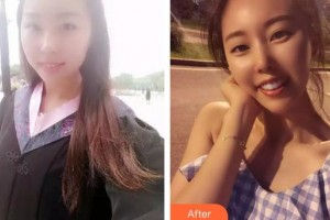 成都藝星醫(yī)療美容醫(yī)院辛定基整形價(jià)格表附陶瓷矯正牙齒案例展示