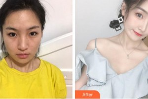 成都恩喜醫(yī)學(xué)整形美容醫(yī)院李成煥整形價(jià)格表附鼻部大改造-鼻部多項(xiàng)案例展示