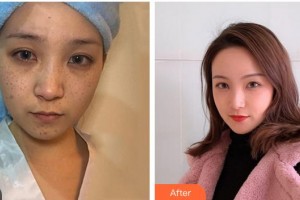 成都艾尚醫(yī)學(xué)美容門診部龔麟整形價(jià)格表附祛斑案例展示