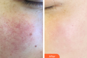 廣州曙光醫(yī)學美容醫(yī)院董沖整形價格表附美白嫩膚案例展示