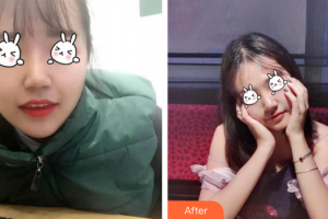 廣州曙光醫(yī)學美容醫(yī)院李承新整形價格表附無針水光案例展示