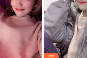 廣州海峽醫(yī)學(xué)整形美容醫(yī)院魏巍整形價(jià)格表附超聲波潔牙案例展示