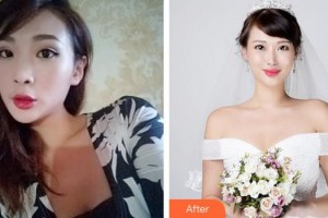 成都素美醫(yī)療美容診所李競整形價(jià)格表附鼻部綜合案例展示