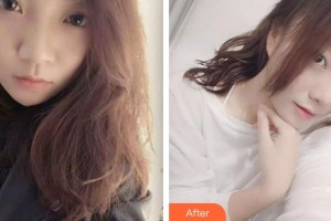 成都蜀尚蓉雅美容整形醫(yī)院馬歡整形價(jià)格表附激光美膚激光案例展示