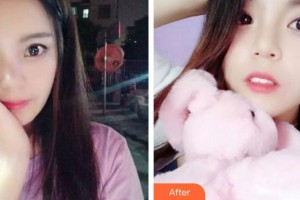 成都華顏醫(yī)療美容門診部黃俊整形價格表附牙綜合案例展示