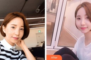 成都柏菲絲醫(yī)學(xué)美容門診部唐豪悅整形價(jià)格表附果酸祛痘案例展示