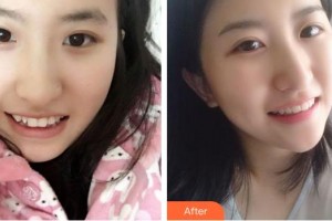 成都拉斐爾口腔門診部方園整形價(jià)格表附美白牙齒案例展示