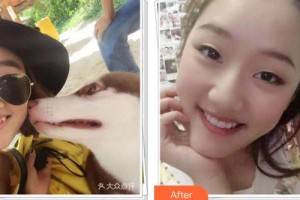 成都華廈眼科醫(yī)院張學進整形價格表附牙齒矯正案例展示