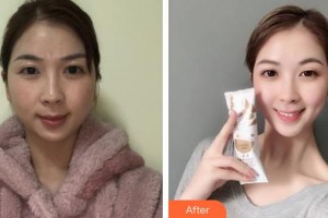 成都愛迪眼科醫(yī)院劉誼整形價格表附牙齒矯正案例展示