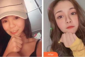 成都華蜀眼科門診部陳來(lái)華整形價(jià)格表附眼部綜合案例展示