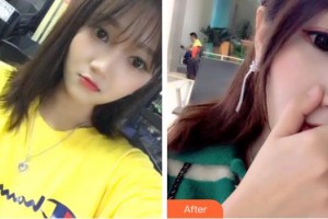 成都純?？谇辉\所劉純虎整形價(jià)格表附超聲波潔牙案例展示