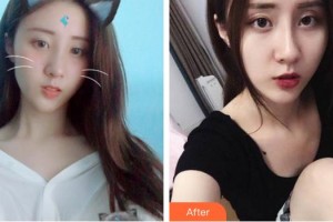 成都中醫(yī)大銀海眼科醫(yī)院周華祥整形價(jià)格表附眼部整形案例展示