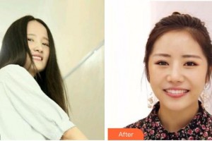 成都皓雅口腔門診部陸相華整形價格表附牙綜合案例展示