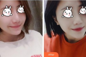 福建武警總隊(duì)醫(yī)院激光美容中心牛克輝整形價(jià)格表附無針?biāo)獍咐故?>
</a>
<h3 class=