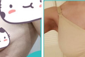 福州中意醫(yī)療美容門診部羅永萍整形價格表附豐胸案例展示