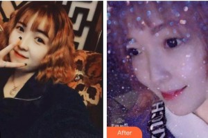 福州市鼓樓醫(yī)院整形美容中心周曼麗整形價格表附超聲波洗牙案例展示