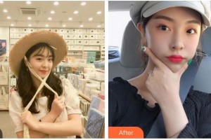 福州愛美爾整形美容醫(yī)院黃林勝整形價格表附抗衰老案例展示