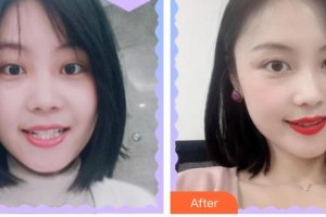 福州曙光整形美容醫(yī)院王斌整形價格表附隱形矯正案例展示