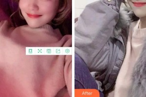 福州格萊美醫(yī)療美容醫(yī)院劉飛順整形價格表附牙綜合案例展示