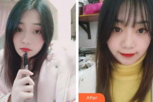 福州登特口腔醫(yī)院劉軍華整形價(jià)格表附牙齒貼面案例展示