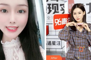 李博整形價格表附牙齒矯正案例展示