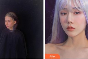 廈門華美名媛整形美容醫(yī)院郭震整形價(jià)格表附熱瑪吉案例展示