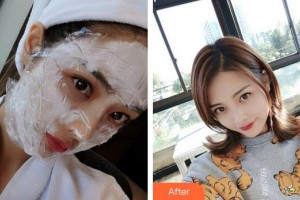 廈門臉博士整形醫(yī)院馬麗整形價(jià)格表附熱瑪吉案例展示