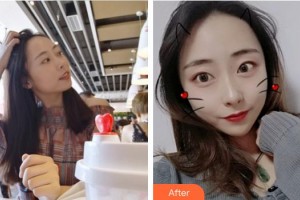 廈門海峽整形美容醫(yī)院易朝華整形價(jià)格表附熱瑪吉案例展示