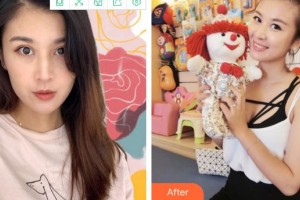 廈門修志夫整形美容醫(yī)院林清福整形價(jià)格表附熱瑪吉案例展示