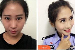 廈門蘭的整形外科門診部廖卿德整形價(jià)格表附鼻部整形案例展示