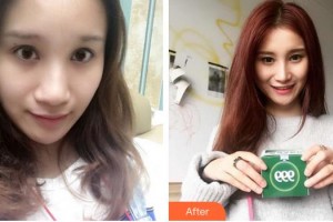 廈門歐韻艷軍醫(yī)療美容診所叢艷軍整形價(jià)格表附鼻部整形案例展示