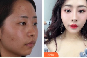 廈門蔡懿醫(yī)療美容診所支婷整形價(jià)格表附抗衰案例展示