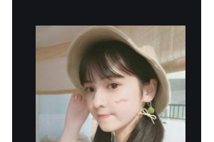 宜昌前衛(wèi)整形美容門診部李煙景整形價(jià)格表附玻尿酸隆鼻案例展示