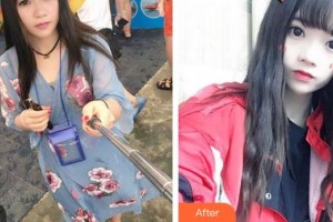 廈門(mén)大學(xué)附屬?gòu)B門(mén)眼科中心醫(yī)院伍端曉整形價(jià)格表附切開(kāi)雙眼皮案例展示