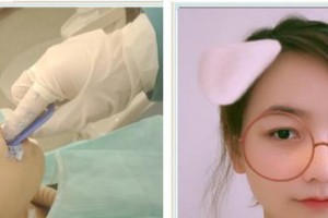 廈門康爾口腔門診部牛懿鋒整形價(jià)格表附隱形牙齒矯正案例展示