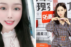 莆田群益口腔門診部鄭桂榮整形價(jià)格表附牙齒矯正案例展示