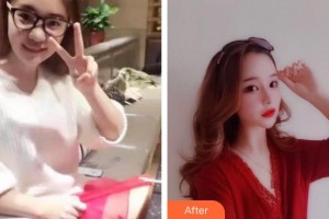 泉州美萊華美整形美容醫(yī)院趙正杰整形價(jià)格表附鼻部綜合案例展示