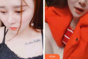 泉州西華醫(yī)療美容醫(yī)院張慧慧整形價格表附口腔案例展示