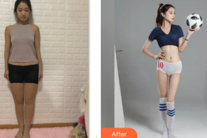 廣州法思脂肪移植醫(yī)學(xué)美容醫(yī)院李越整形價格表附腰腹環(huán)吸+大小腿吸脂案例展示