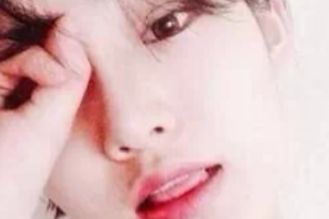 宜昌愛(ài)合口腔醫(yī)院汪芳整形價(jià)格表附種植牙案例展示