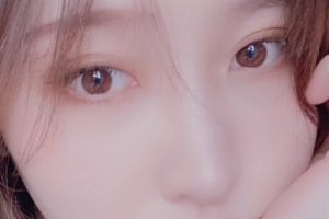 西安女子醫(yī)院醫(yī)學(xué)美容科張國孝整形價格表附面部吸脂案例展示