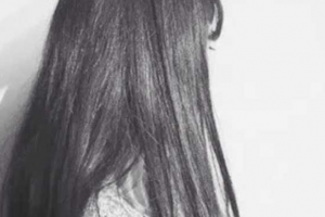 西安市第三人民醫(yī)院醫(yī)學(xué)整形美容中心沈剛民整形價格表附假體墊眉弓案例展示