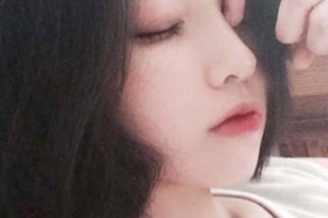 西安艾薇美醫(yī)療美容門診部王冀耕整形價格表附膨體墊下巴案例展示