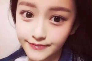 西安市邵醫(yī)生整形美容診所邵錦弘整形價格表附V-LINE瓜子瘦臉手術(shù)案例展示