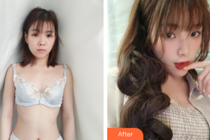 廣州慕美醫(yī)療美容醫(yī)院蕭嘉住院醫(yī)師整形價格表附自體脂肪隆胸案例展示