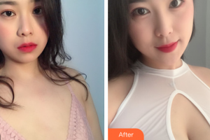 廣州南珠醫(yī)療美容門診部蔣海軍整形價格表附自體脂肪隆胸案例展示