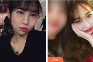 龍巖華美醫(yī)療美容醫(yī)院黃梅麗整形價格表附激光美膚祛斑案例展示